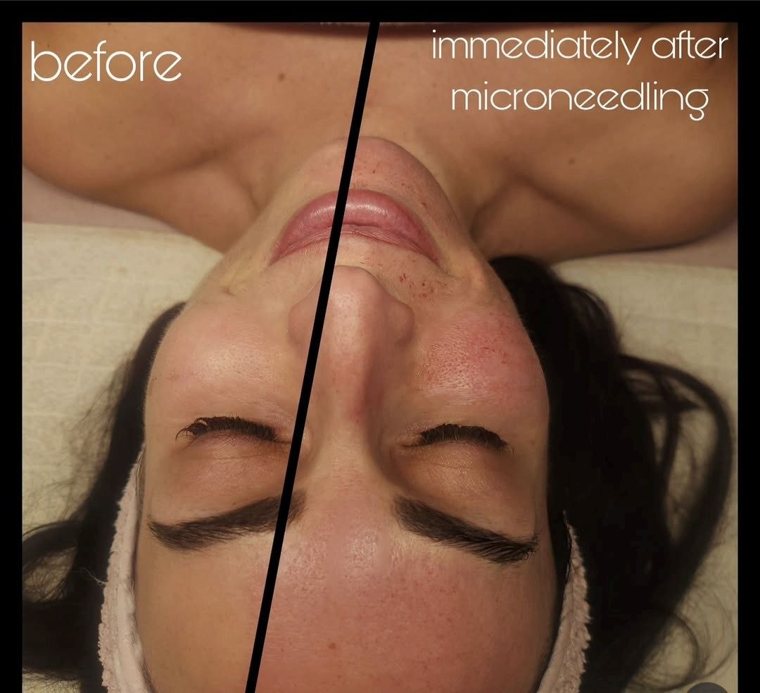 Lo and Behold Beauty facial results and skincare in Peterborough